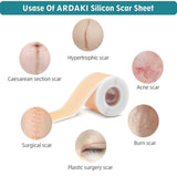 Silicon Scar Removal Tape