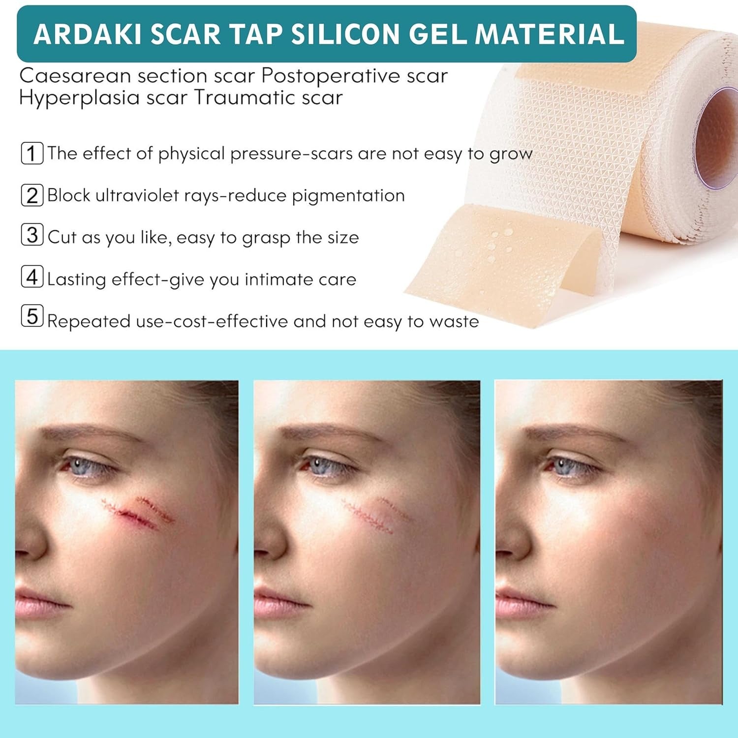 Silicon Scar Removal Tape