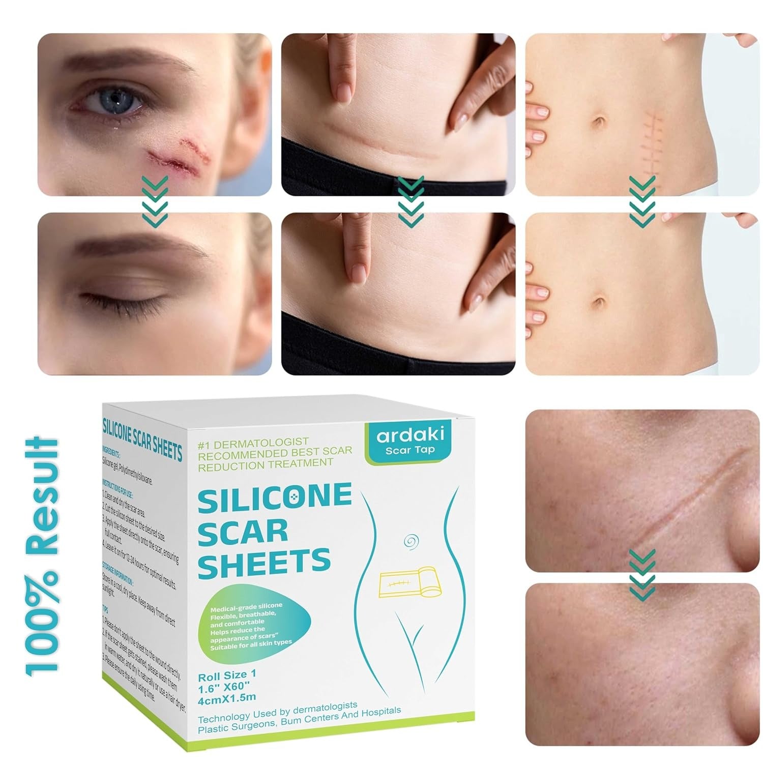 Silicon Scar Removal Tape