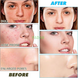 Turmeric Kojic Acid Face Cleansing Foaming Pads